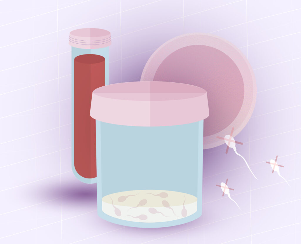 Infertilidad masculina